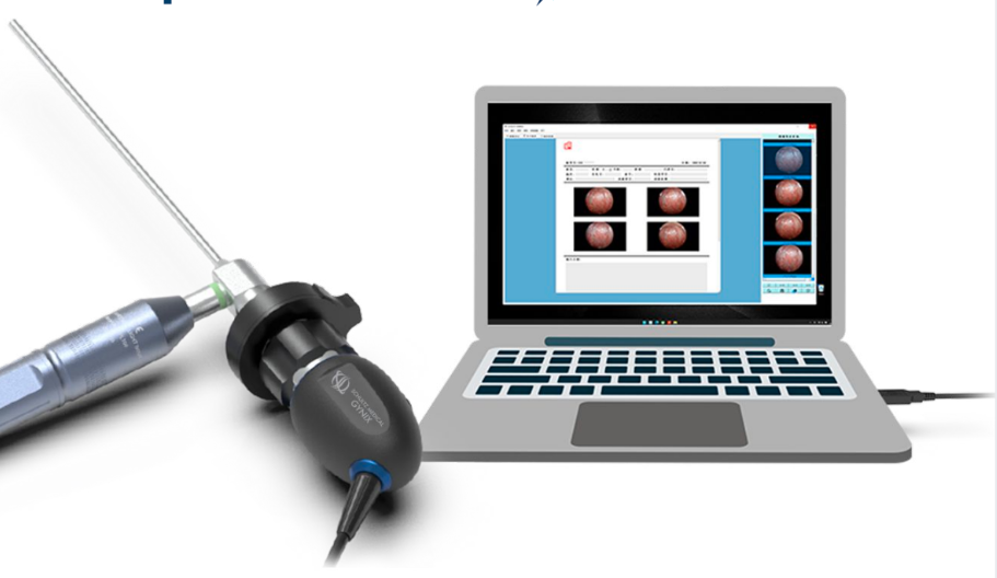 Sistema di telecamere per endoscopi USB portatili - Shultz Medical